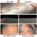 HD Lace VS LY Lace